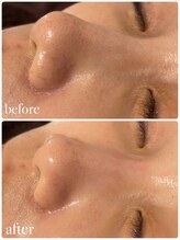 リノベル(LINOBELLE)/一度で実感！