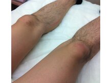 ディアナ(La Grand Belle Diana)/メンズ脱毛　23年の実績