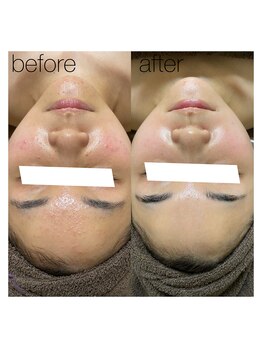 ホズリル(Hozril)/目指せ艶肌ノーファンデ