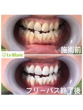 ルブラン 奈良店(Le Blanc)/必ず映える事間違い無し！