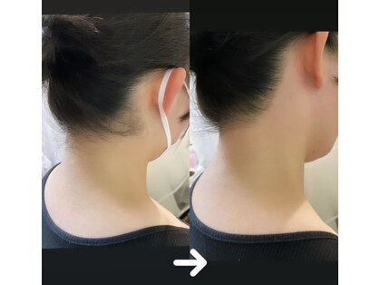 屋根裏 アティック(attic)の写真