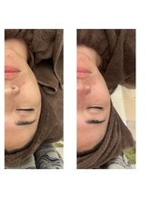 ヴィヴ コレビ(VIV COREBI)/マッサージ付き