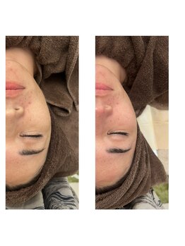 ヴィヴ コレビ(VIV COREBI)/マッサージ付き