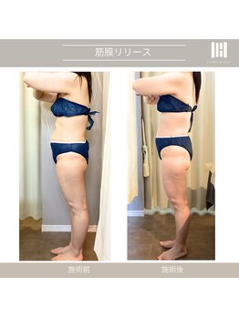 カリスボーテ 関本店/カリス式排出筋膜リリース