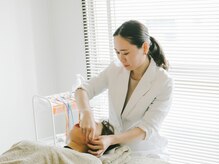 アキュネ 福岡薬院店(acune)/福岡/薬院/美容鍼/美肌