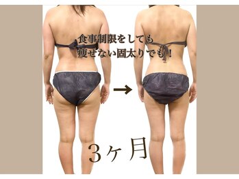 ウェリナポノビューティサロン(welina pono beauty salon)/《痩身/ダイエット/小顔》