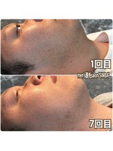 シンバ 倉敷店(SIMBA)/