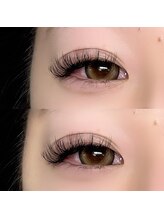 アイラ 天神橋店/バインドロック80束