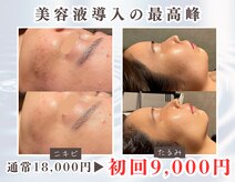 シュウ(Shuu)