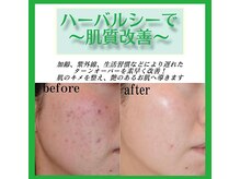 【即効性抜群！ハーバルシー】初回価格￥14,300（税込）