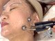 ソルテシュガーリング(SORTE sugaring)の写真/【小顔・美肌になるカギは”土台を整えること”】表情筋トレーニングでしっかり効果実感!小顔/リフトアップ