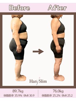 ビーネ 札幌琴似/ハリスリム 札幌琴似(Beene/Hari-Slim)/3ヶ月-13.7kg