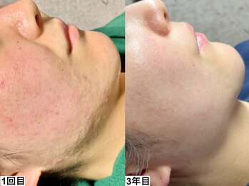 アンドミー 池袋(&me)/肌状態に合わせたメニューを提案