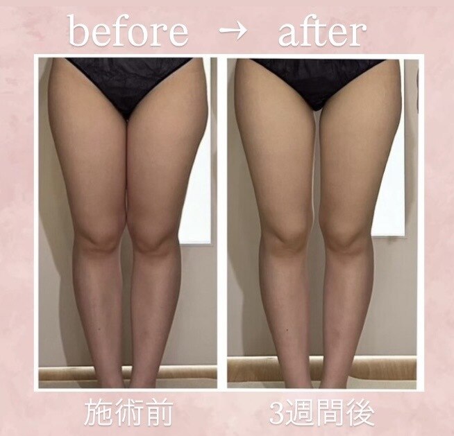 パルティール 恵比寿店(partir)｜ホットペッパービューティー