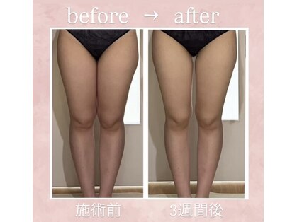 パルティール 恵比寿店(partir)の写真