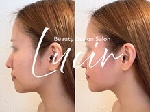 ルシール 仙台店(lucir)/<小顔骨気> Before/After