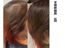 ボニータ(Bonita)/【頭皮Lit】ヒト羊膜幹細胞