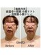 マルウル(maluulu)の写真/年齢サインにアプローチ！【頭蓋骨×頸椎 小顔リフト】で老け対策＆小顔を徹底サポート♪首肩こり解消◎