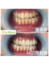 ルブラン 奈良店(Le Blanc)/夏休みを利用して(^ ^)