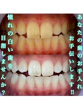 ホワイトニングショップ 成田店/【憧れの白い歯へ】