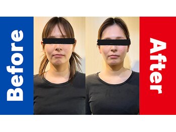 ザ コンディショニングルーム コガオスタジオ 自由が丘店(KOGAOSTUDIO)/ビフォーアフター　顔