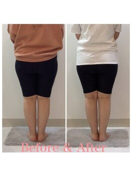 スタイルラボ高松/産後骨盤矯正の効果♪