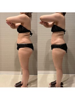 ギャラクシービューティー(galaxy beauty)/深部マッサ－ジ