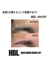 ヴィシアス(VIXIAS)/ハリウッドブロウリフト