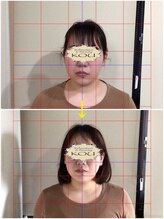 リラクゼーションアンドビューティー コウ(Kou)/【美容整骨/小顔&左右差調整】