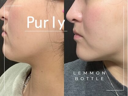 ピュアリー(purly)の写真