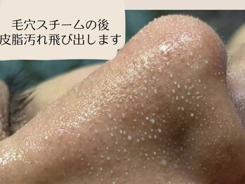 キッキー(Kicky)の写真/夏のドロドロ皮脂汚れ&角栓に大人気毛穴ケア!!2タイプの商材でお鼻中心にお顔全体ケア☆