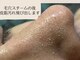 キッキー(Kicky)の写真/夏のドロドロ皮脂汚れ&角栓に大人気毛穴ケア!!2タイプの商材でお鼻中心にお顔全体ケア☆