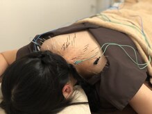ビヨウハリセイタイ エヌサンテシンキュウチリョウイン(N サンテ針灸治療院)