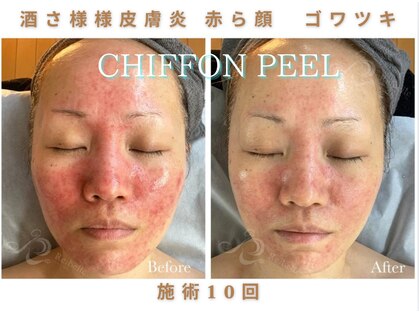 クリア 麻布十番(CLEAR)の写真
