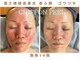 クリア 麻布十番(CLEAR)の写真