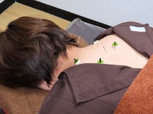 乃々鍼灸整体院 表参道/鍼灸×整体