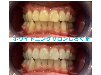 シロクマ(siroQMa)/黄ばみがすっきり