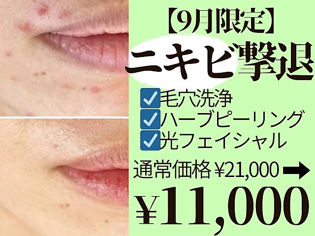 LAESSE ラエッセ　ハーブピーリング➕トライアル等 LAESSE ラエッセ ハーブピーリング➕トライアル等 - メルカリ