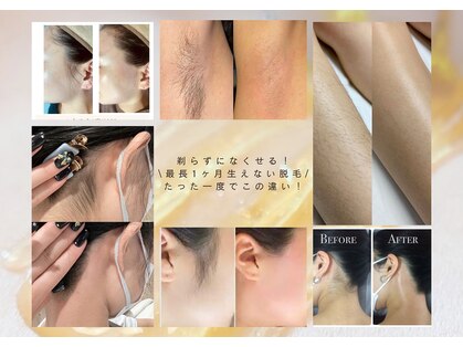 シュガーリングハウスレディ(SugaringHouse LADY)の写真