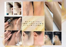 シュガーリングハウスレディ(SugaringHouse LADY)