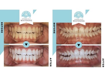 ホノルルホワイトニング 京橋店の写真
