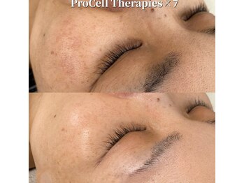 クレア(crea)/お肌【プロセルセラピーズ】金山