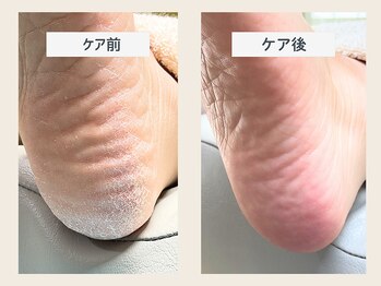 ルポ 伊勢/足裏角質ケア