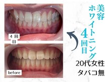 ルカノン(le canon)/笑顔の素敵な女性になりました☆