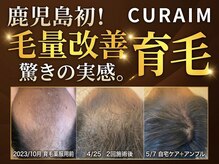 キュライム(CURAIM)