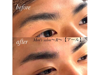 アール(R)の写真