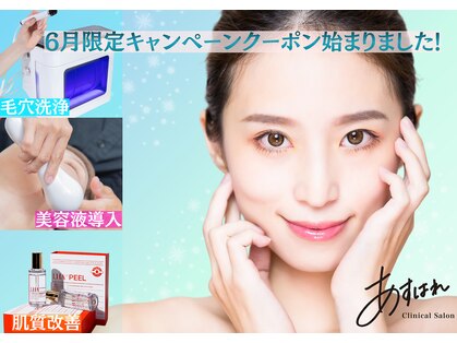 あすはれの写真