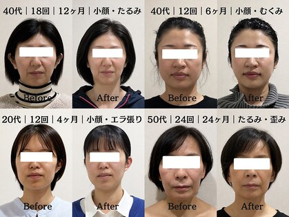 マルウル(maluulu)の写真