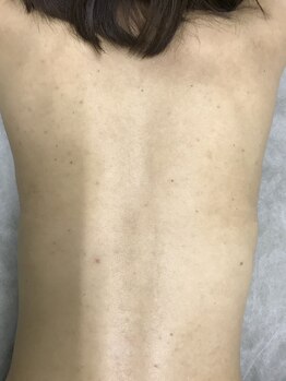 ナノハナ/鹿沼市本格全身脱毛ナノハナ