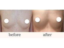 ミリミリ(mili mili)/バスト変化